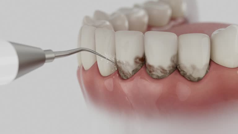 Trusted Root Canal Treatment service in Breckinridge Center, KY - Dentist Open Now